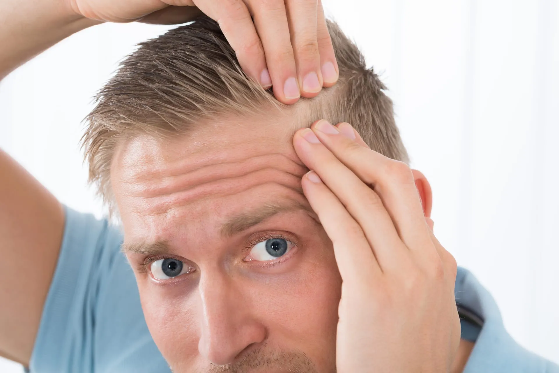 Man pushing his hair back and looking at his hairline