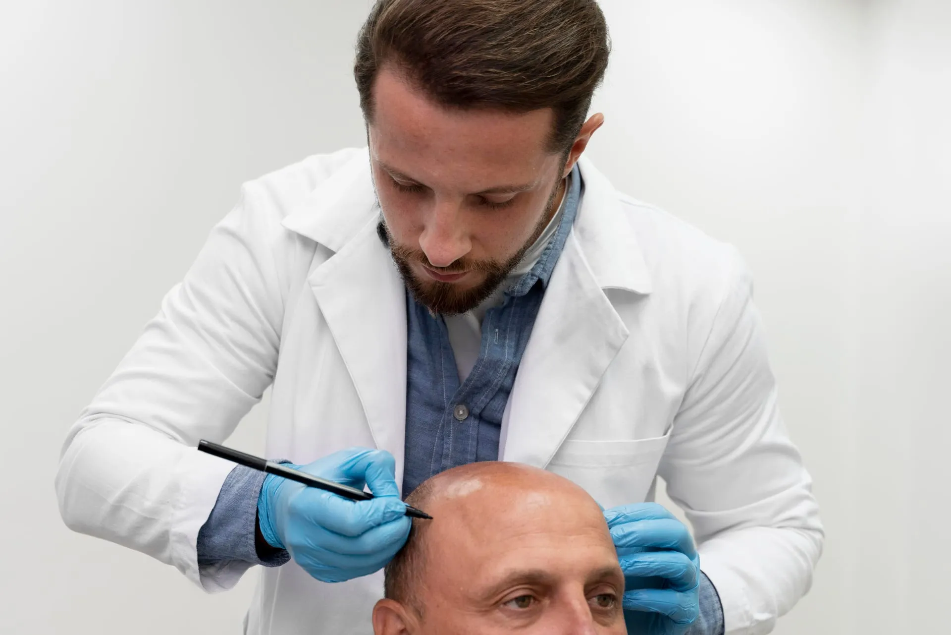 Arzt zeichnet mit einem Stift auf der Kopfhaut eines Patienten an
